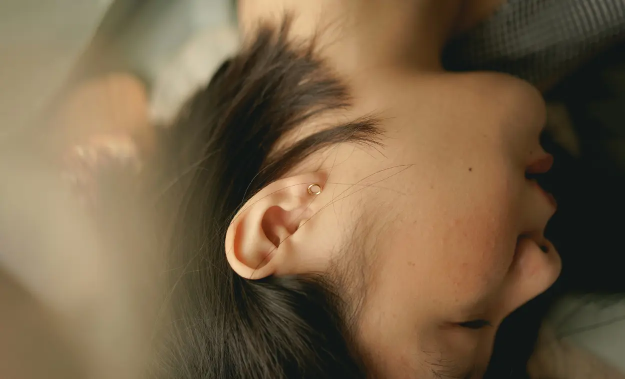 Prominent Ear Correction