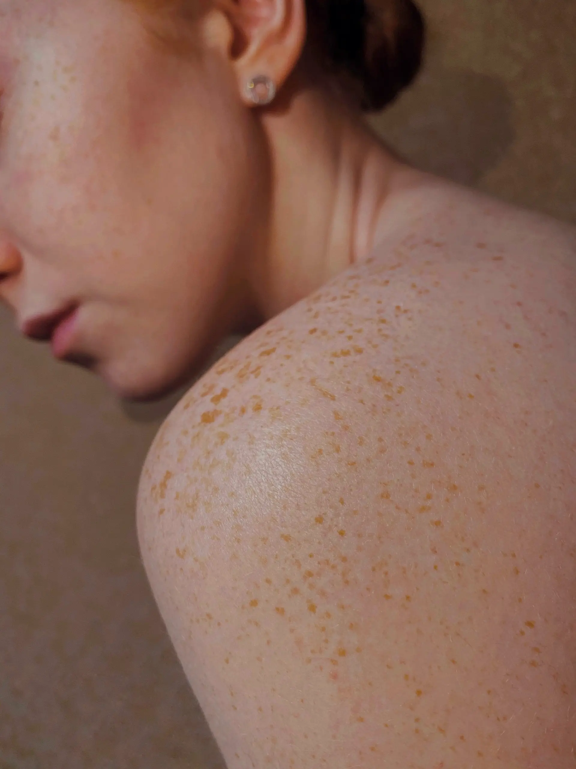 |||Cellulite Reduction|