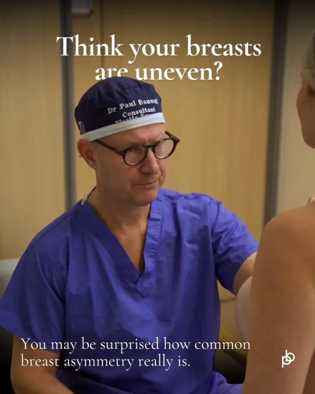 Think your breasts are uneven? You’re certainly not alone 🖤 

Breast asymmetry is incredibly common, and in many cases the differences are subtle enough that we barely notice them.

It also isn’t always as simple as one breast being larger than the other. Differences can exist in breast volume, shape, nipple position, projection, the inframammary fold and even the underlying chest wall.

Treatment isn’t always necessary. The first step is understanding why the asymmetry exists and discussing the options available. Remember ‘sisters not twins’ is a valuable phrase to remember and even after surgery minor asymmetries will exist. 

Having said that asymmetry corrections can be immensely beneficial for emotional and psychological wellbeing and our patients are extremely grateful. 

Save this post if you’re researching breast surgery for asymmetry, or leave your questions for Dr Paul below 👇🏽 

🔗 paulebanwell.com