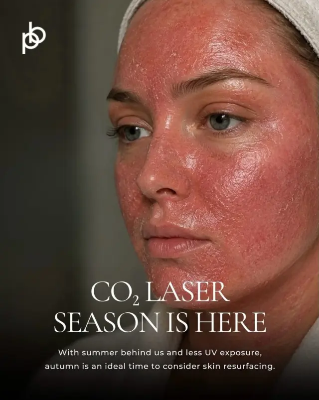 CO₂ laser season has officially arrived. 🍂

As we move into autumn and UV exposure naturally reduces, it’s an ideal time to start thinking about the more intensive skin treatments many of us put on hold during the summer months.

CO₂ laser works by resurfacing the skin while stimulating collagen remodelling beneath the surface - helping to improve concerns including sun damage, fine lines, uneven texture and scarring over time.

And with Christmas still a few months away, October is a great time to begin. Skin renewal isn’t instant; allowing time for recovery and continued collagen remodelling means the improvements can continue to develop in the weeks that follow.

Thinking about investing in your skin this autumn?

💌 Send us a private message with your questions, or book a consultation with Dr. Paul via the link in our bio to find out whether CO₂ laser is right for you🖤